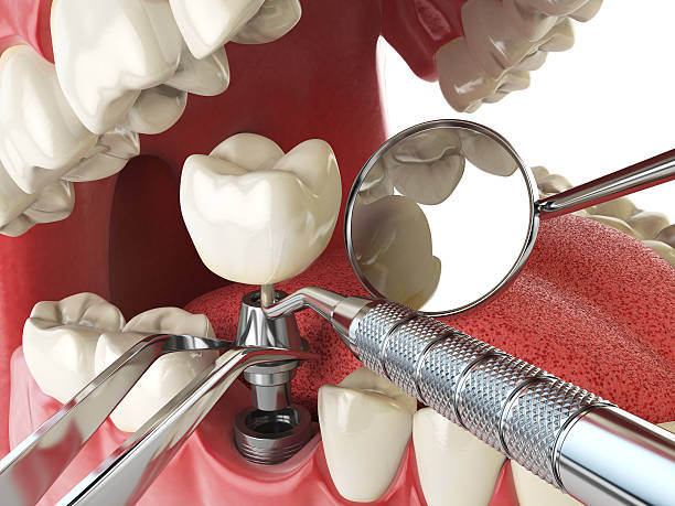 Best Emergency Gum Treatment in Cambridge Springs, PA